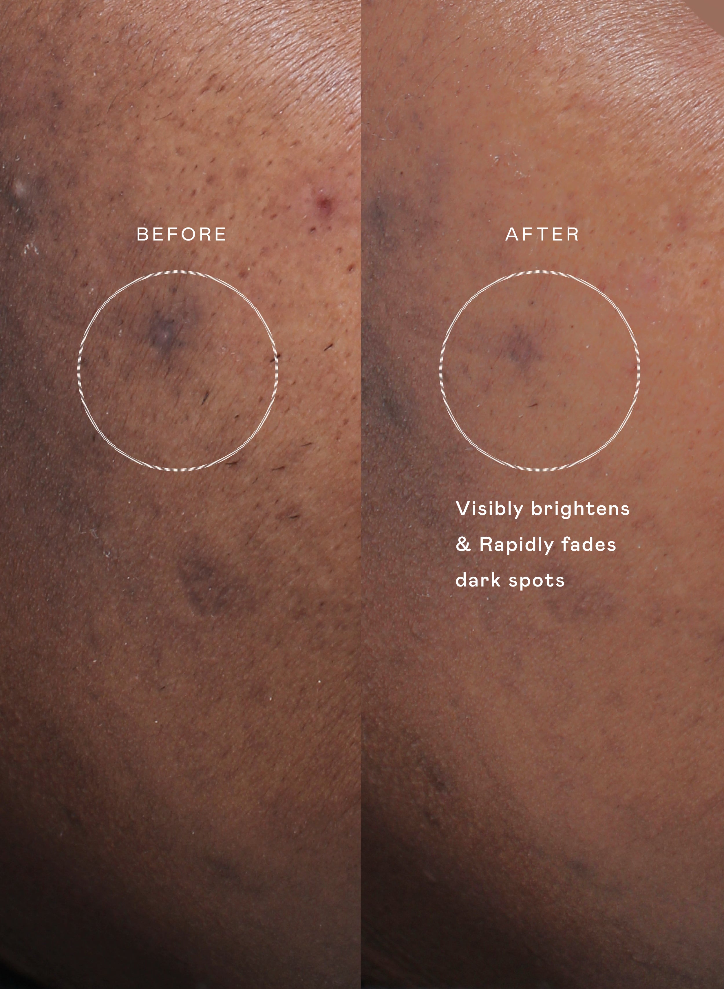 The Even Skin Set | EADEM