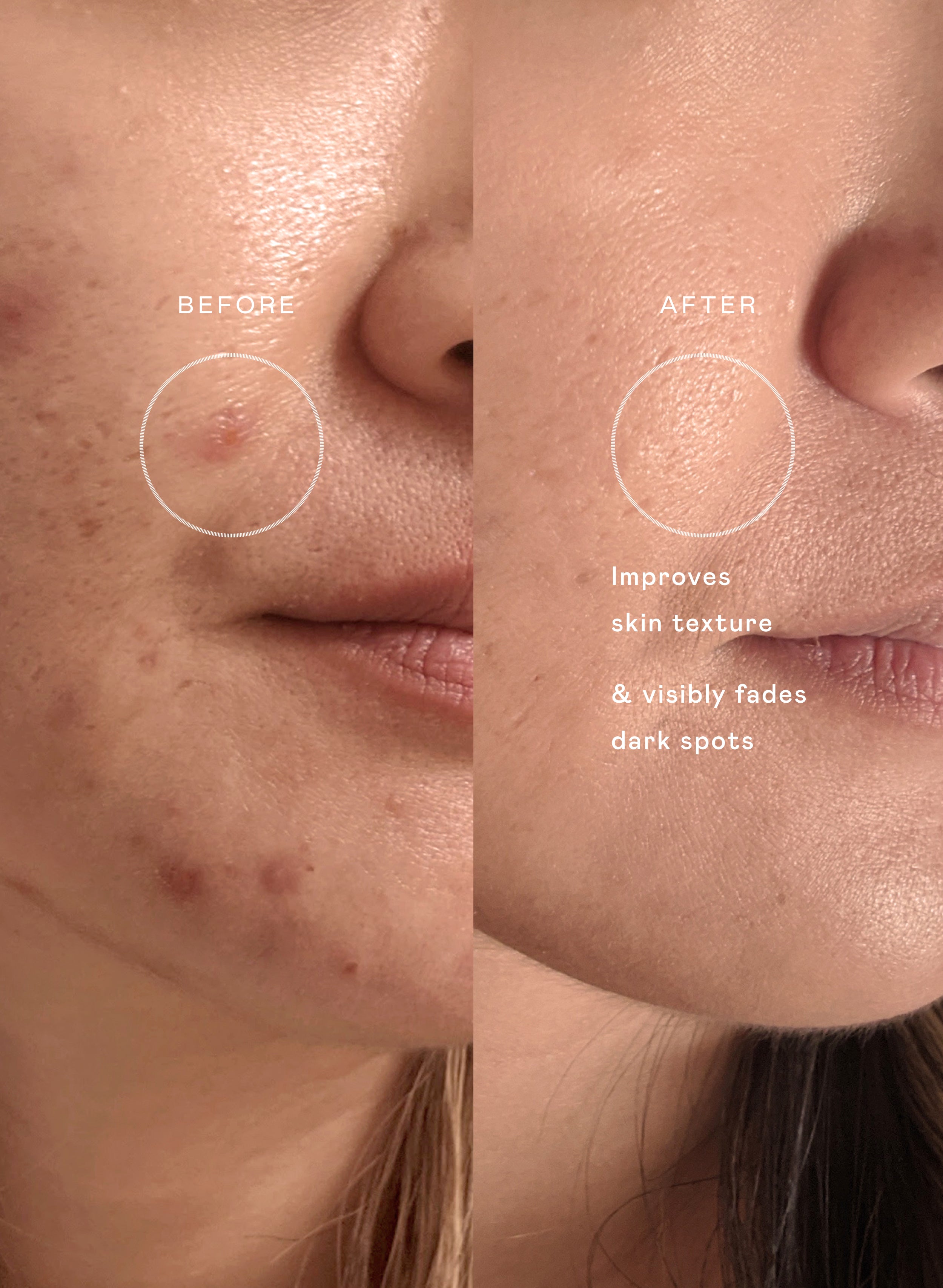 The Motherhood Set | EADEM