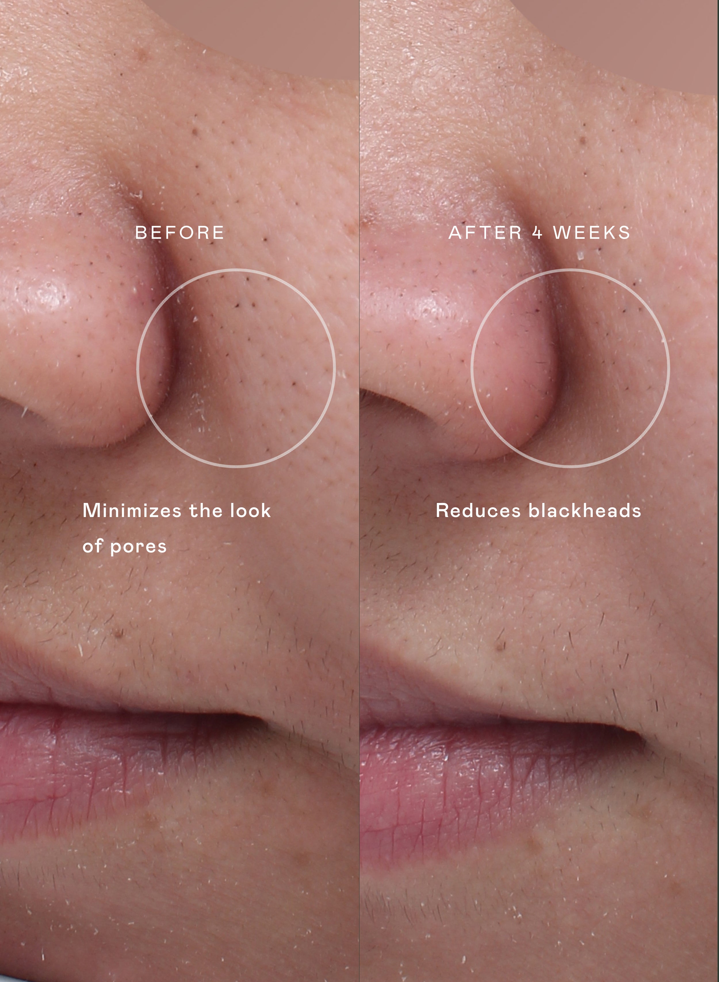 The Even Skin Set | EADEM