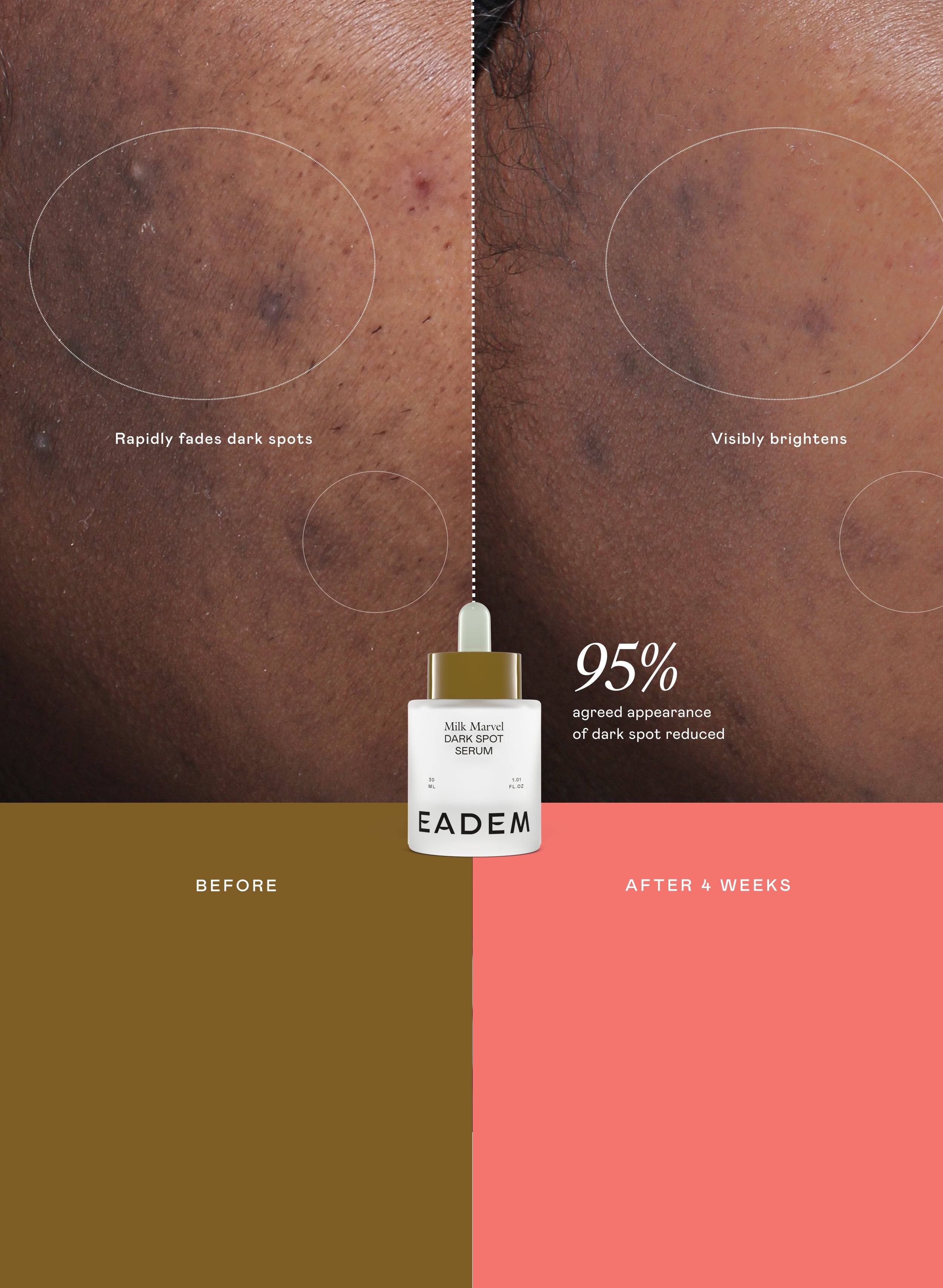 Dark Spot Expert | EADEM